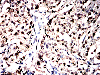 ANP32A Antibody