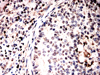 ANP32A Antibody