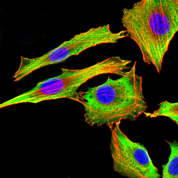 ANP32A Antibody