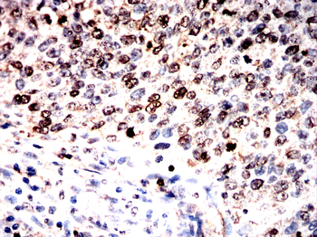 ANP32A Antibody