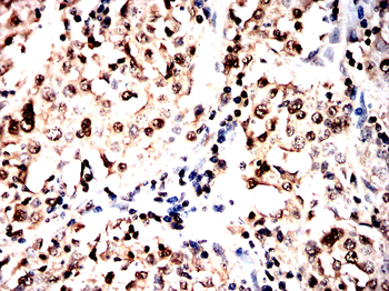 ANP32A Antibody