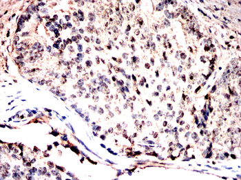 ANP32A Antibody
