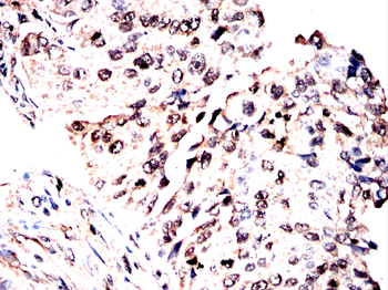 CDT1 Antibody