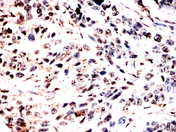 CDT1 Antibody