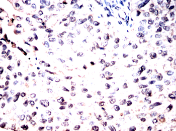 CDT1 Antibody