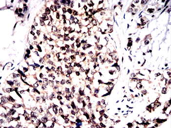 STK4 Antibody