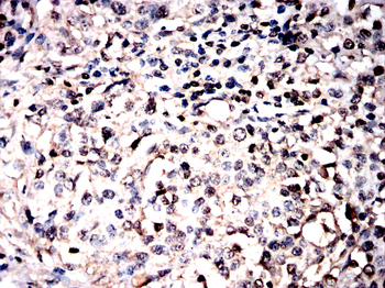 VCP Antibody