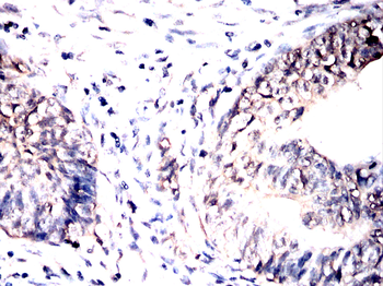 VCP Antibody