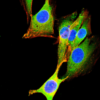 CFL1 Antibody
