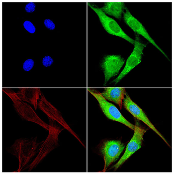 NDUFAF2 Antibody