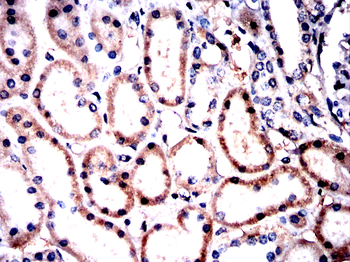 ABL1 Antibody