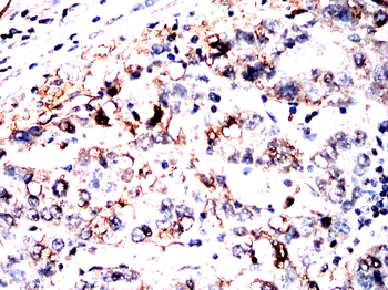ABL1 Antibody