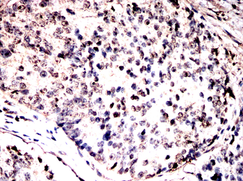 ABL1 Antibody