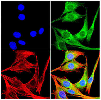 ALOX15 Antibody