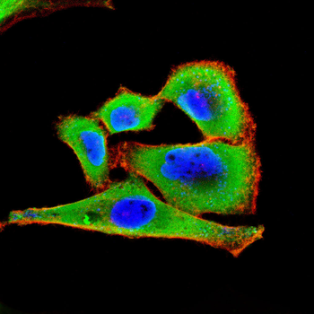 ALOX15 Antibody