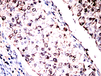 CAND1 Antibody