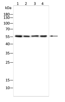 PPP3CA Antibody