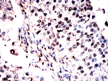 PPP3CA Antibody