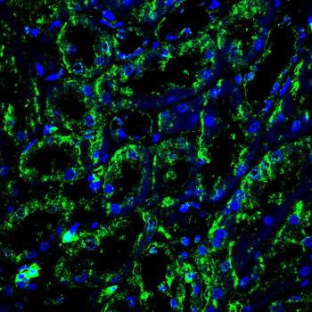 PPP3CA Antibody