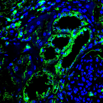 PPP3CA Antibody
