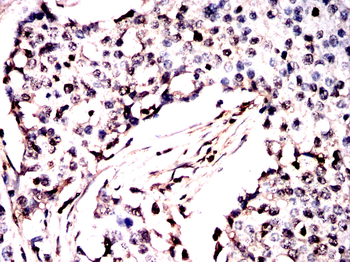 PPP3CA Antibody