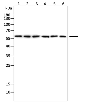 PPP3CA Antibody