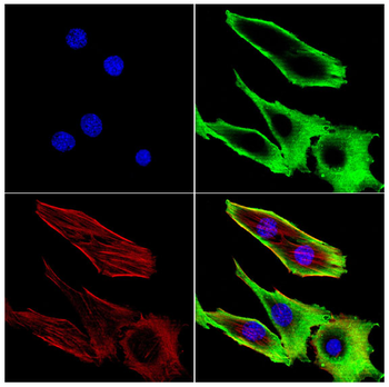 IL13RA2 Antibody