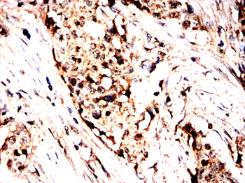 IL13RA2 Antibody