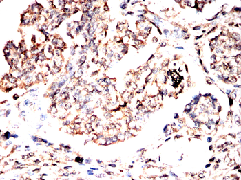 SMS Antibody
