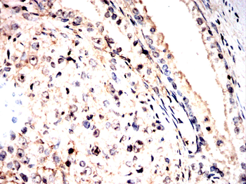CTSL/CTSV/CTSK/CTSH Antibody