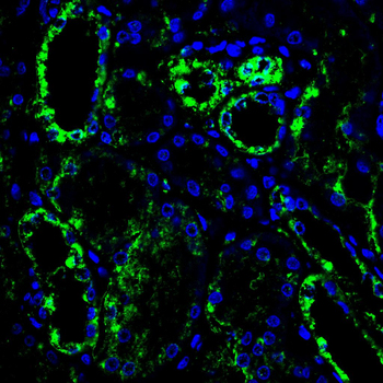 PDHA1 Antibody