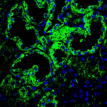 NDUFS4 Antibody
