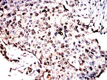 TAF15 Antibody