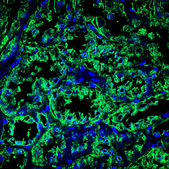 SCARB2 Antibody