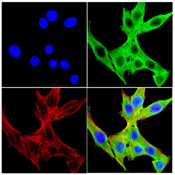 CALM1/CALM2/CALM3 Antibody