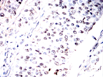 NR2F2 Antibody