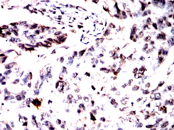 NR2F2 Antibody