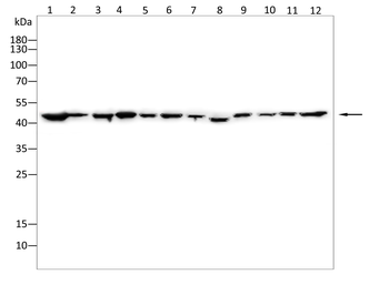 NR2F2 Antibody