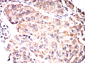 PSAT1 Antibody