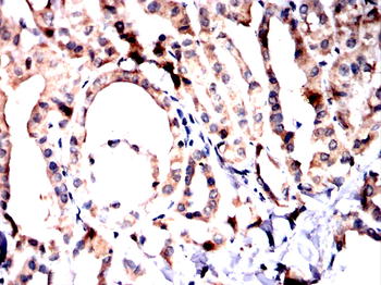 PSAT1 Antibody