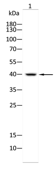 PSAT1 Antibody