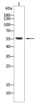 CAMK2D Antibody