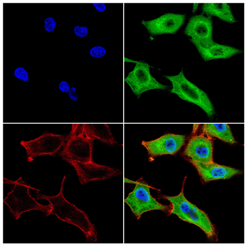 CSNK1A1/CSNK1A1L Antibody