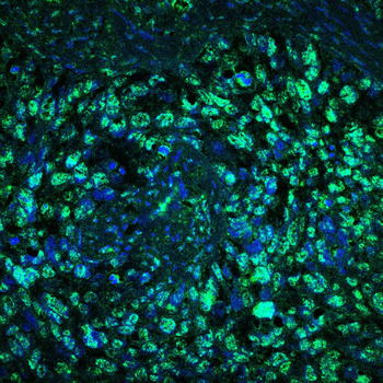CSNK1A1/CSNK1A1L Antibody