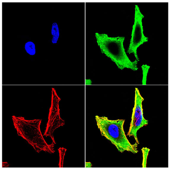 CSNK1A1/CSNK1A1L Antibody