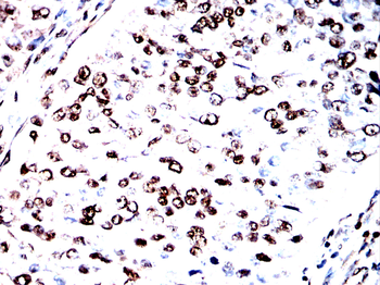 TRIM25 Antibody