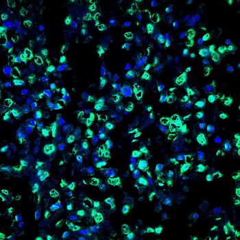 TRIM25 Antibody