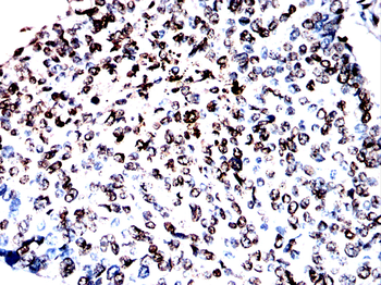 TRIM25 Antibody