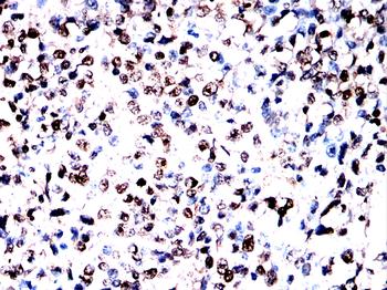 TRIM25 Antibody