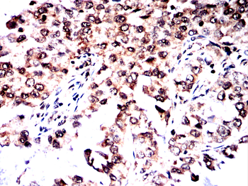 TRIM25 Antibody